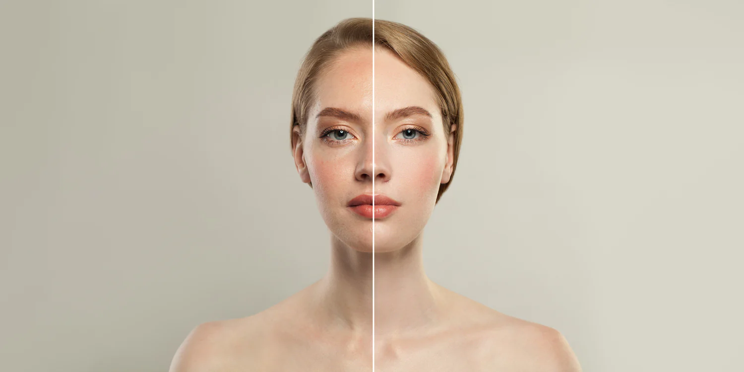 The Truth About Collagen Boosters – Do They Really Work?